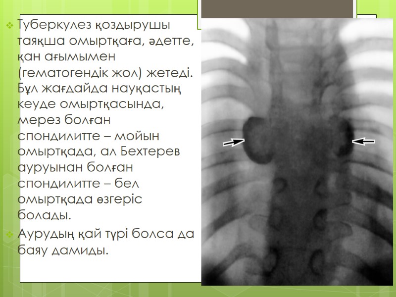 Туберкулез қоздырушы таяқша омыртқаға, әдетте, қан ағымымен (гематогендік жол) жетеді. Бұл жағдайда науқастың кеуде
